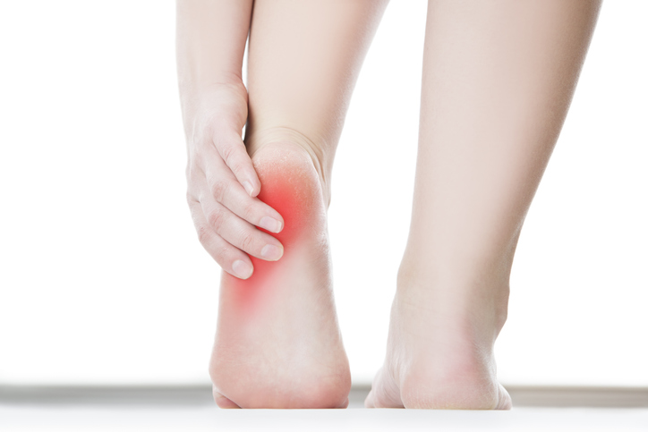 Plantar fascia tear: How to manage - Sport Doctor London